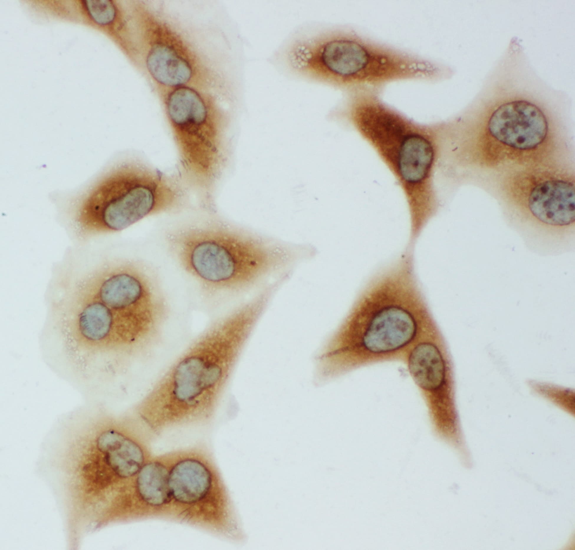 Polyclonal Rabbit anti-Human HSPA9 / Mortalin / GRP75 Antibody (aa591-609, IHC, WB)