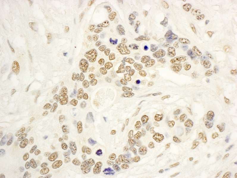 NOL8 Antibody (aa1117-1167)