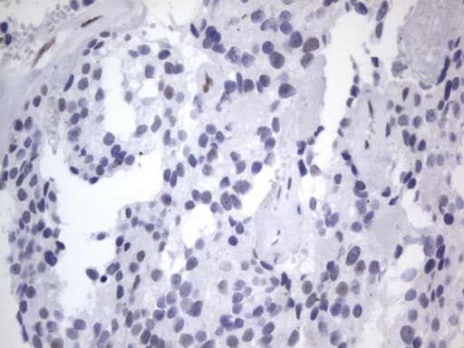 RBFOX1 / A2BP1 Antibody (aa1-210, clone OTI4F9)