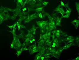 Monoclonal Mouse anti-Human BUB1B / BubR1 Antibody (clone OTI6E5, IHC, IF, WB)