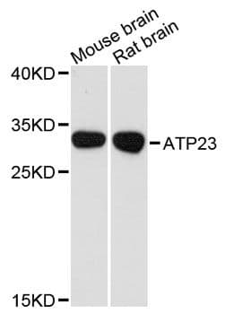 XRCC6BP1 Antibody