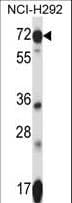 SLC41A2 Antibody (aa35-63)