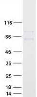 Human GNL1 Protein (Recombinant Myc-DDK (Flag))