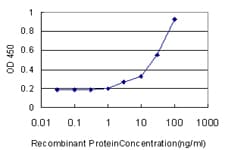 IHC-plus™ DCN / Decorin Antibody (clone 3H4-1F4)