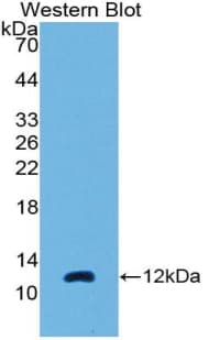 CCL7 / MCP3 Antibody (aa24-97)