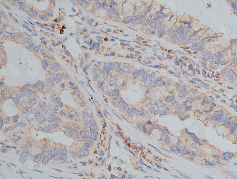 Hamartin / TSC1 Antibody