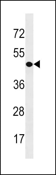 CDY1 Antibody (aa1-30)