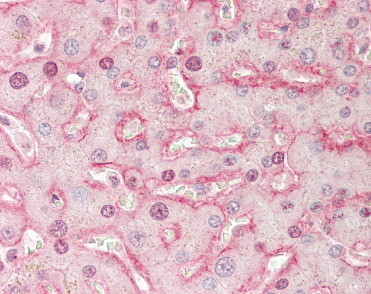PPP2R5D Antibody (C-Terminus)