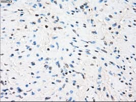 Monoclonal Mouse anti-Human ZFP36 / Tristetraprolin Antibody (clone OTI8B5, IHC, IF, WB)