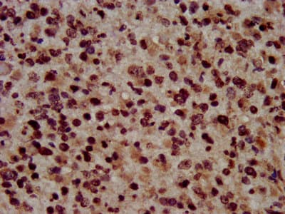 Polyclonal Rabbit anti-Human HIST1H3A Antibody (IHC, IF, WB)