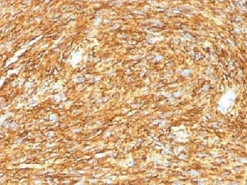 ANO1 / DOG1 / TMEM16A Antibody (clone DG1/1485)