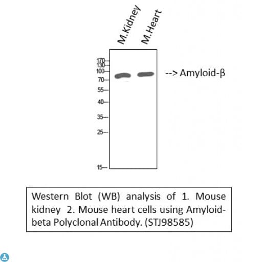 Polyclonal Rabbit anti-Human APP / Beta Amyloid Precursor Antibody (WB)