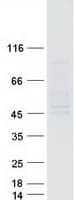 Human ASPHD1 Protein (Recombinant Myc-DDK (Flag))