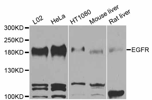 Polyclonal Rabbit anti-Human EGFR Antibody (IHC, IF, WB)