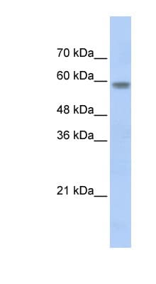 Polyclonal Rabbit anti-Human NRF1 / NRF-1 Antibody (aa360-409, IHC, WB)