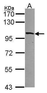 IHC-plus™ MYO1B / Myosin IB Antibody (aa916-1136)