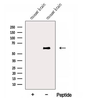 Polyclonal Rabbit anti-Human ENPP4 Antibody (WB)