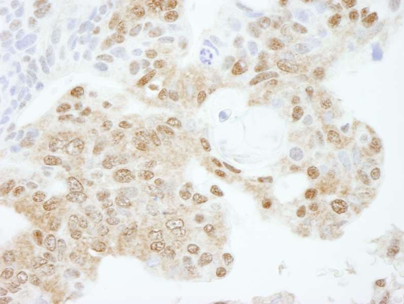 KPNA3 / Importin Alpha 4 Antibody (aa1-50)