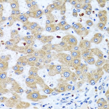 NMU / Neuromedin U Antibody