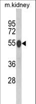 CAT / Catalase Antibody (aa152-180)