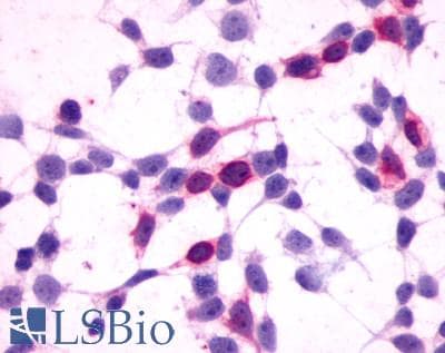 PathPlus™ Polyclonal Rabbit anti-Human GPR27 Antibody (N-Terminus, IHC)