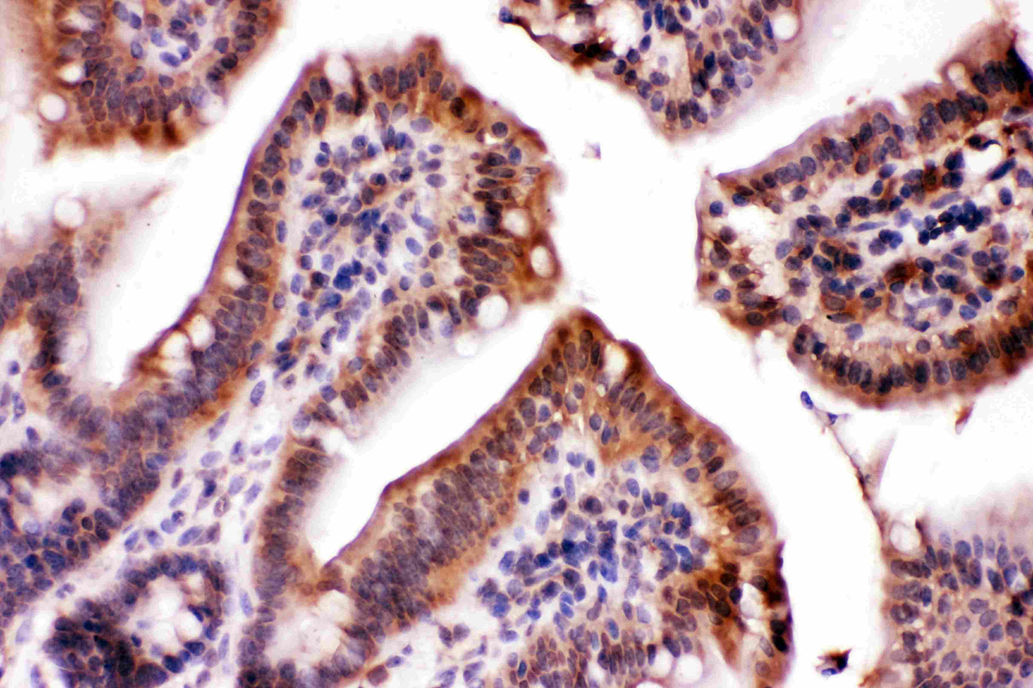 Polyclonal Rabbit anti-Human LDHA / LDH1 Antibody (IHC, WB)