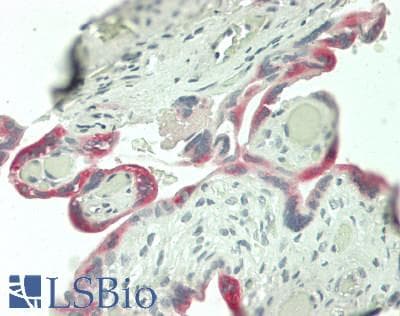 IHC-plus™ Polyclonal Rabbit anti-Human ADAM12 Antibody (IHC, WB)