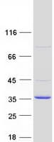 Human COMTD1 Protein (Recombinant Myc-DDK (Flag))