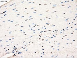 MAP2K1 / MKK1 / MEK1 Antibody (clone OTI1C1, Carrier-free)