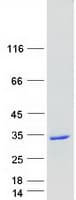 Human RAB27B Protein (Recombinant Myc-DDK (Flag))