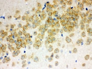 OTOF / Otoferlin Antibody