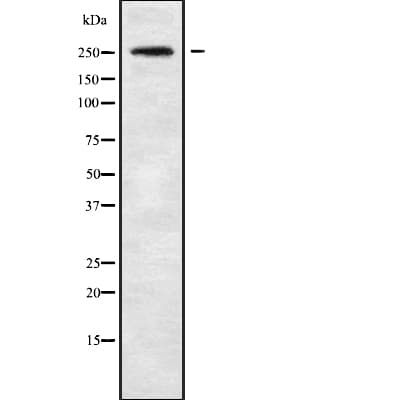 Polyclonal Rabbit anti-Human MYO7A / Myosin-VIIa Antibody (WB)