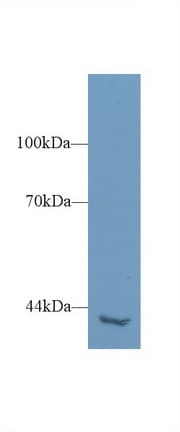 PLCH2 Antibody (HRP)