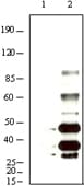 Monoclonal Mouse anti-Human Herpesvirus 8 HHV-8 K8 alpha Antibody (clone 8C12G10G1, IHC, WB)