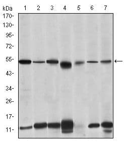 IRAK4 / IRAK-4 Antibody (clone 2H9)
