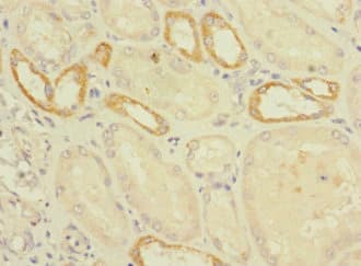 Polyclonal Rabbit anti-Human C2orf76 Antibody