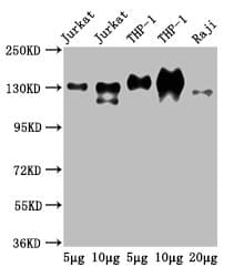PECAM-1 / CD31 Antibody (clone 9E6E12)