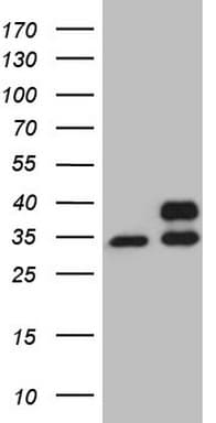 SDHB Antibody (clone OTI1E4)