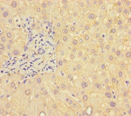 Polyclonal Rabbit anti-Human B4GALT5 Antibody