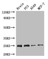 Polyclonal Rabbit anti-Human APOPT1 Antibody (WB)