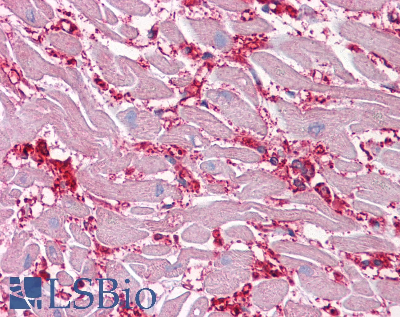 PathPlus™ ENO1 / Alpha Enolase Antibody (clone 8G8)