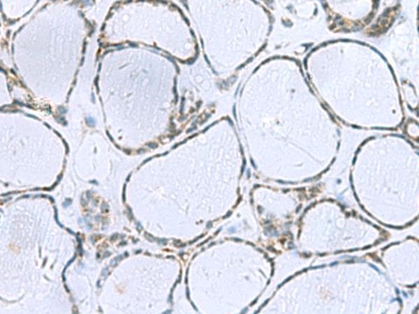 POMC / Proopiomelanocortin Antibody