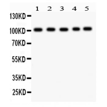 SLC4A1 / Band 3 / AE1 Antibody (aa28-365)