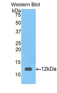 S100A12 Antibody (aa1-92)