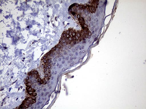 Monoclonal Mouse anti-Human P4HA3 Antibody (clone OTI9A2, IHC)