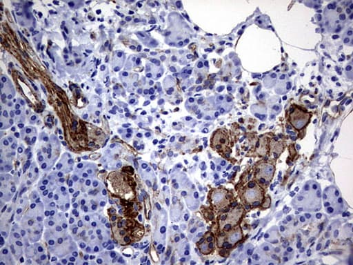 MCAM / CD146 Antibody (clone OTI5C4)