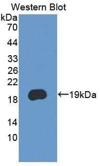 PCDH20 Antibody (aa64-209)