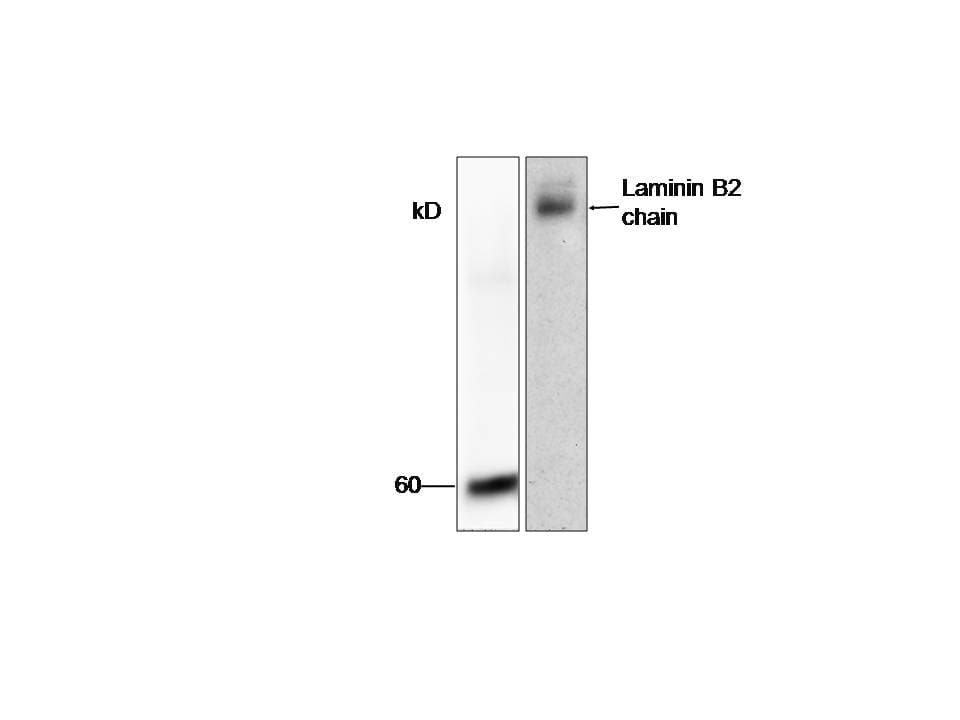 PathPlus™ LAMC1 / Laminin Gamma 1 Antibody (aa526-1106)
