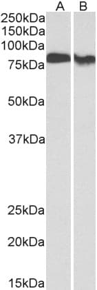 IHC-plus™ Polyclonal Goat anti-Human PRKCB / PKC-Beta Antibody (aa631-642, IHC, WB)