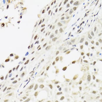 Polyclonal Rabbit anti-Human C14orf166 Antibody (IHC, WB)